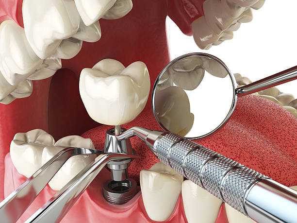 Best Mobile Emergency Dentist in Green Valley, CA